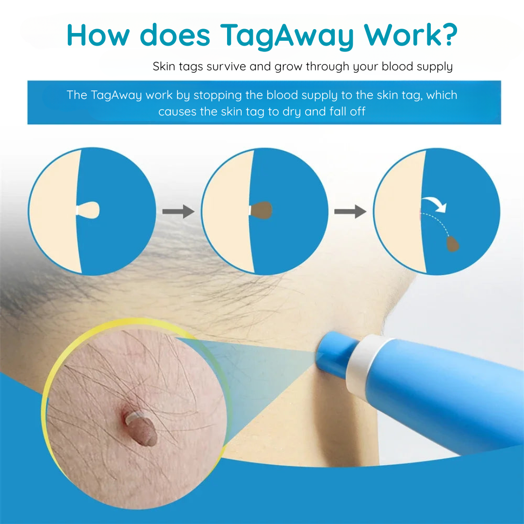 TagAway Kit