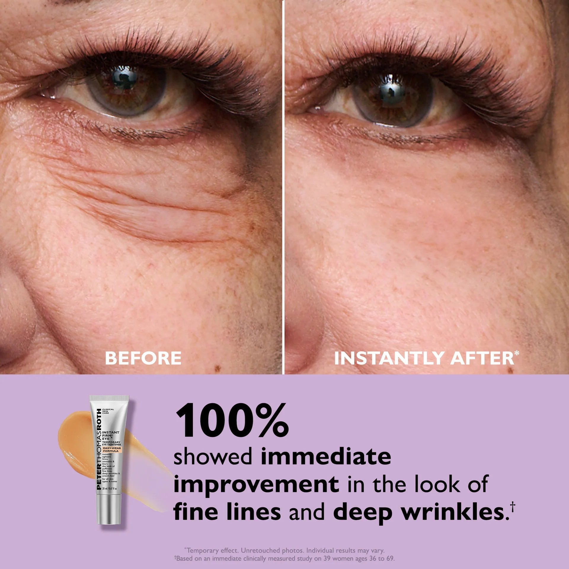 Instant Eye Tightening Cream – Solvera