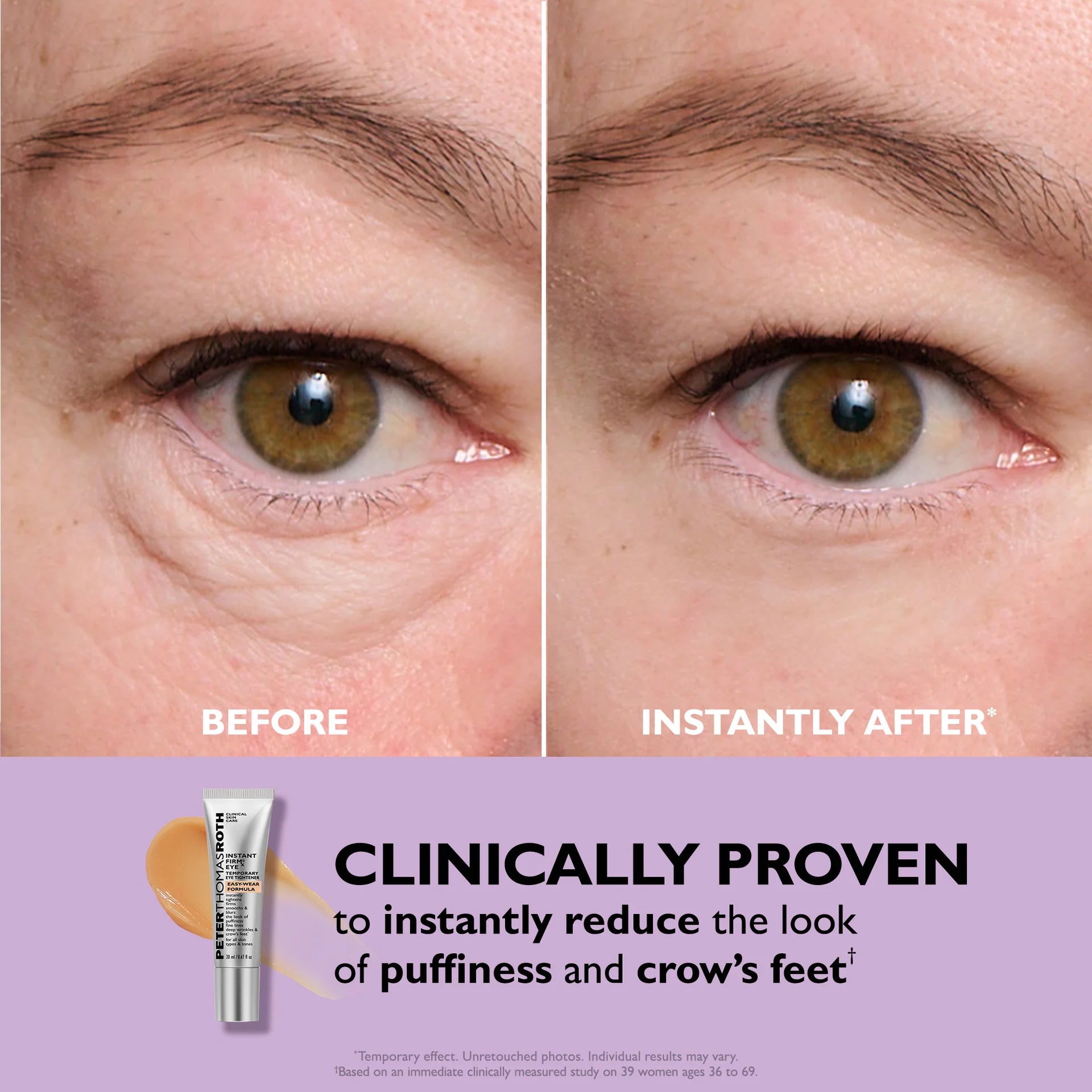 Instant Eye Tightening Cream – Solvera