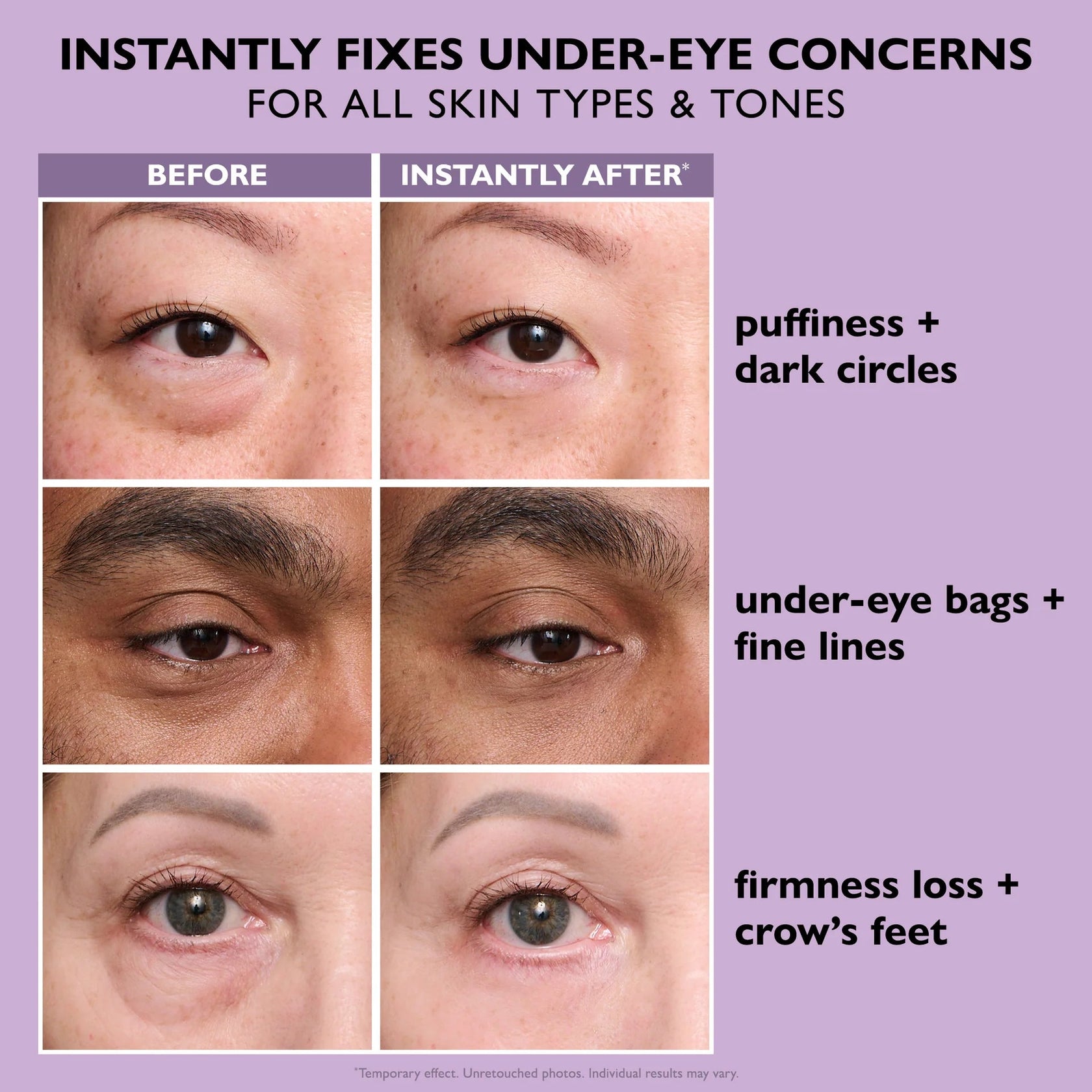 Instant Eye Tightening Cream – Solvera